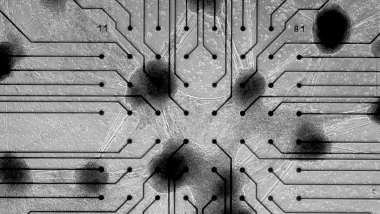 tecnologia - computador - neurônios - cérebro