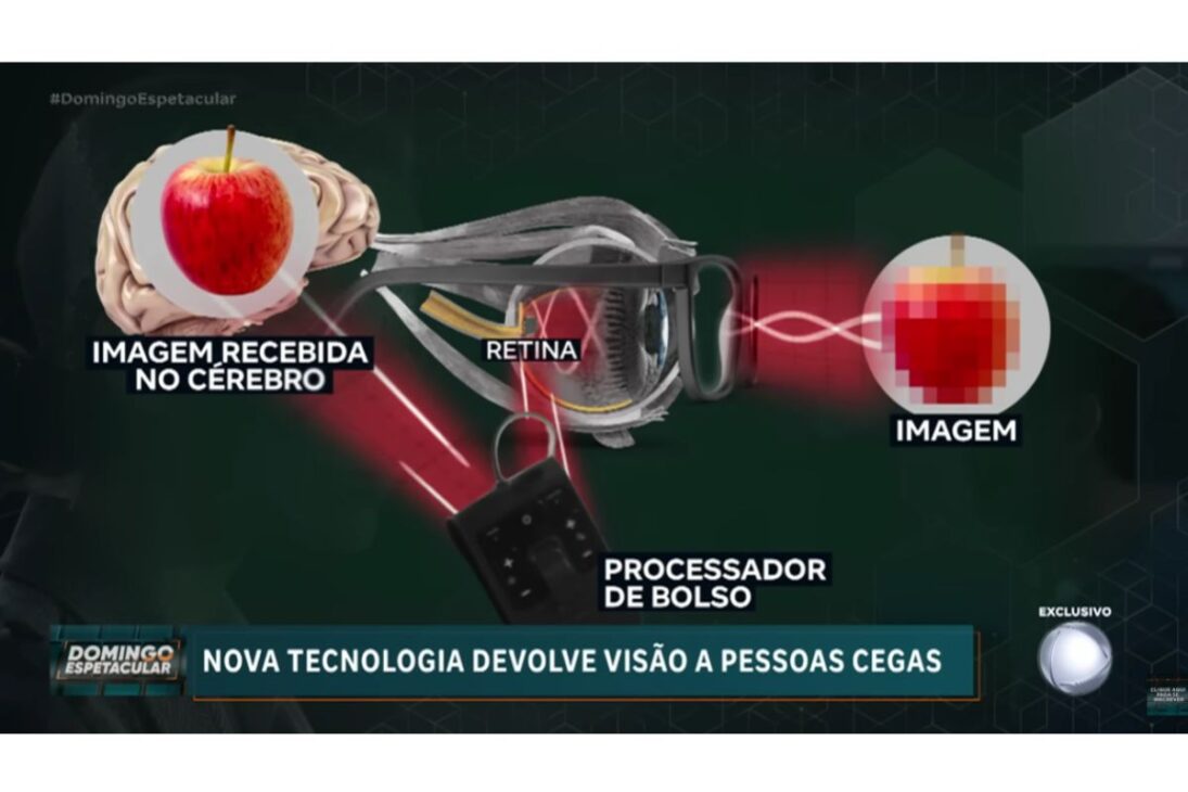 Uma nova tecnologia usa microchip fotovoltaico implantado na retina para devolver visão parcial, atuando em casos de degeneração macular e doença de Stargardt e reacendendo a esperança de pacientes.